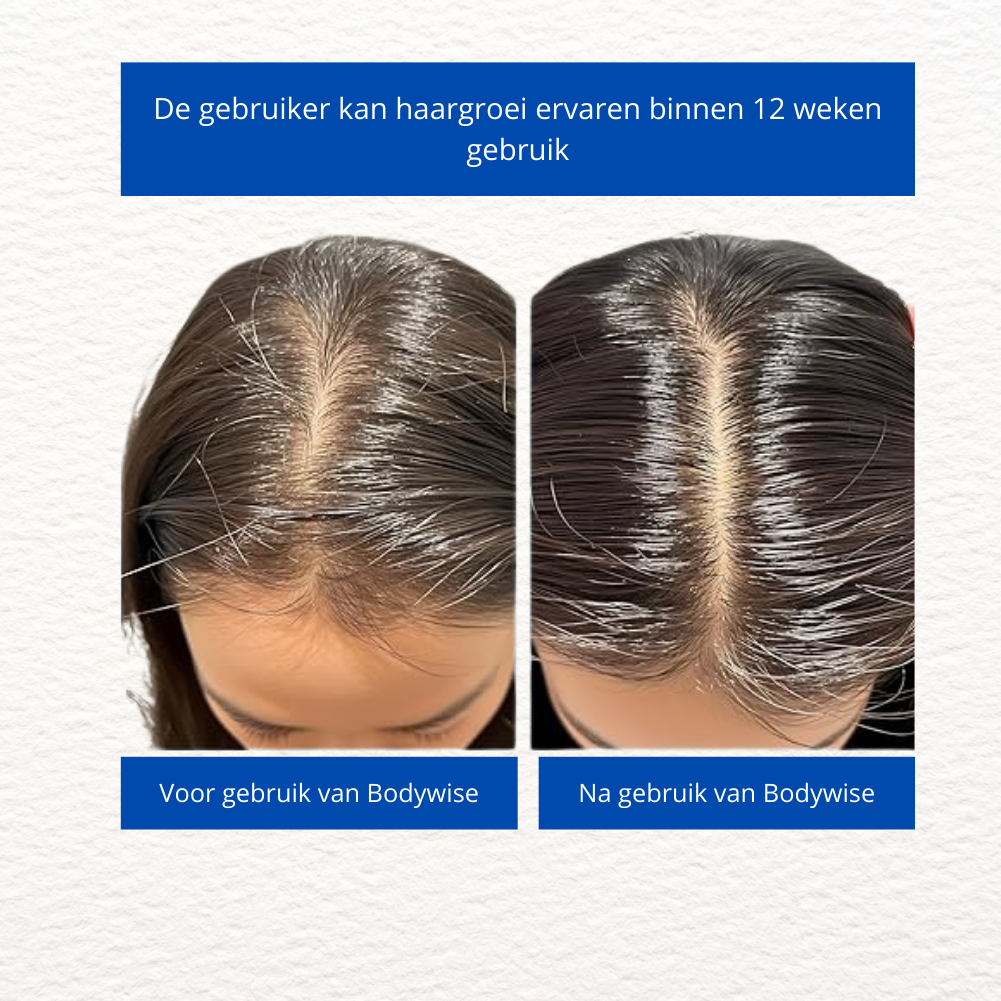 Bodywise Rozemarijn Repair